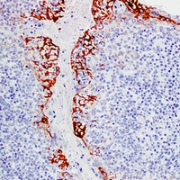 IF - Anti-MUC1 Antibody AP61609